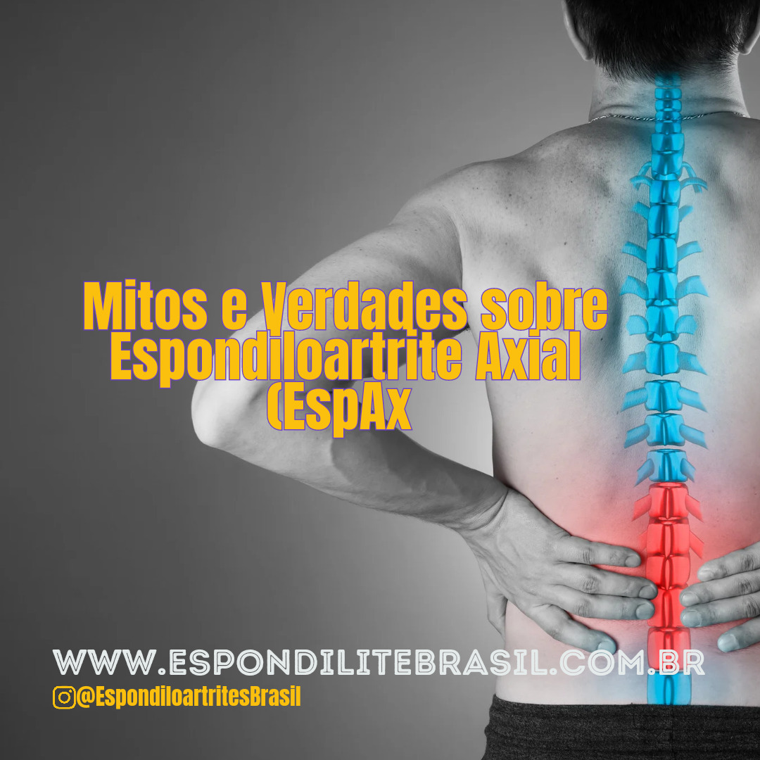 Mitos e Verdades sobre Espondiloartrite Axial