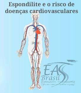alt="Homens com Espondilite idade de 60-69 tem risco maior para doenças cardiovasculares" 