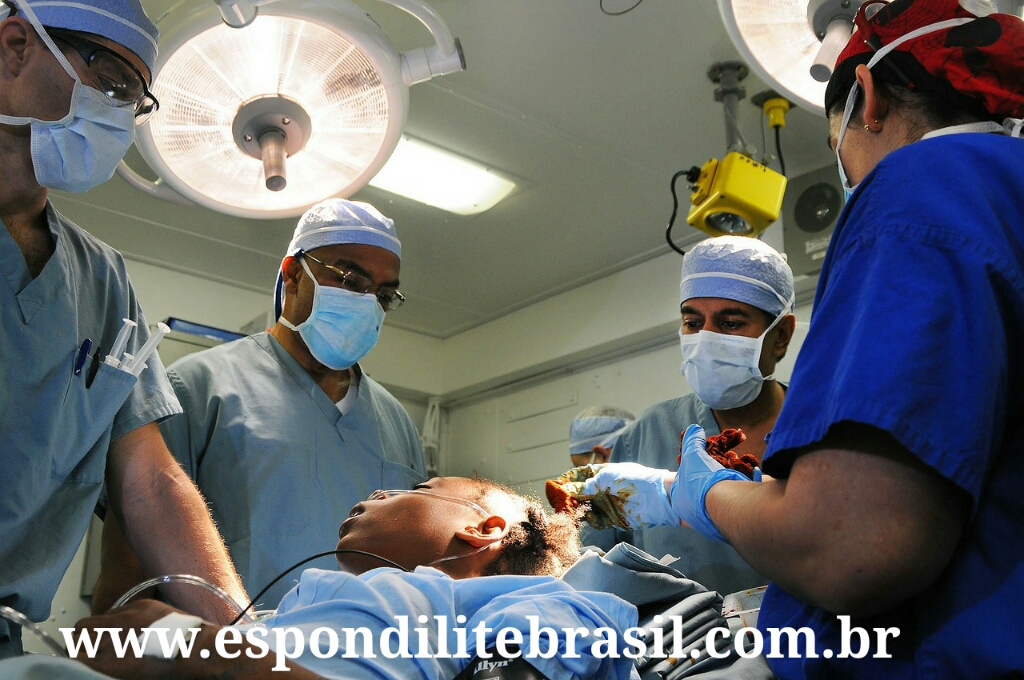 Indicações de cirurgia da coluna para tratar espondilite