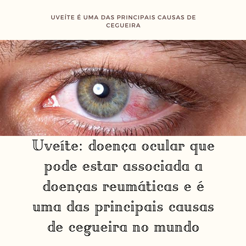 Uveíte é uma das principais causas de cegueira